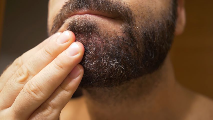 Descamación de la barba: Soluciones | Todocabello.net