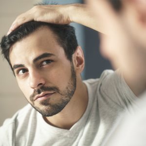 caída de pelo en hombres